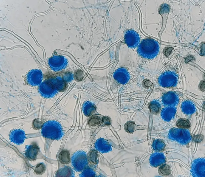Microscopic image of Aspergillus fumigatus by LPCB stain