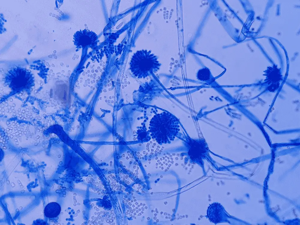 Aspergillus spp. under a light microscope at 40× magnification after staining